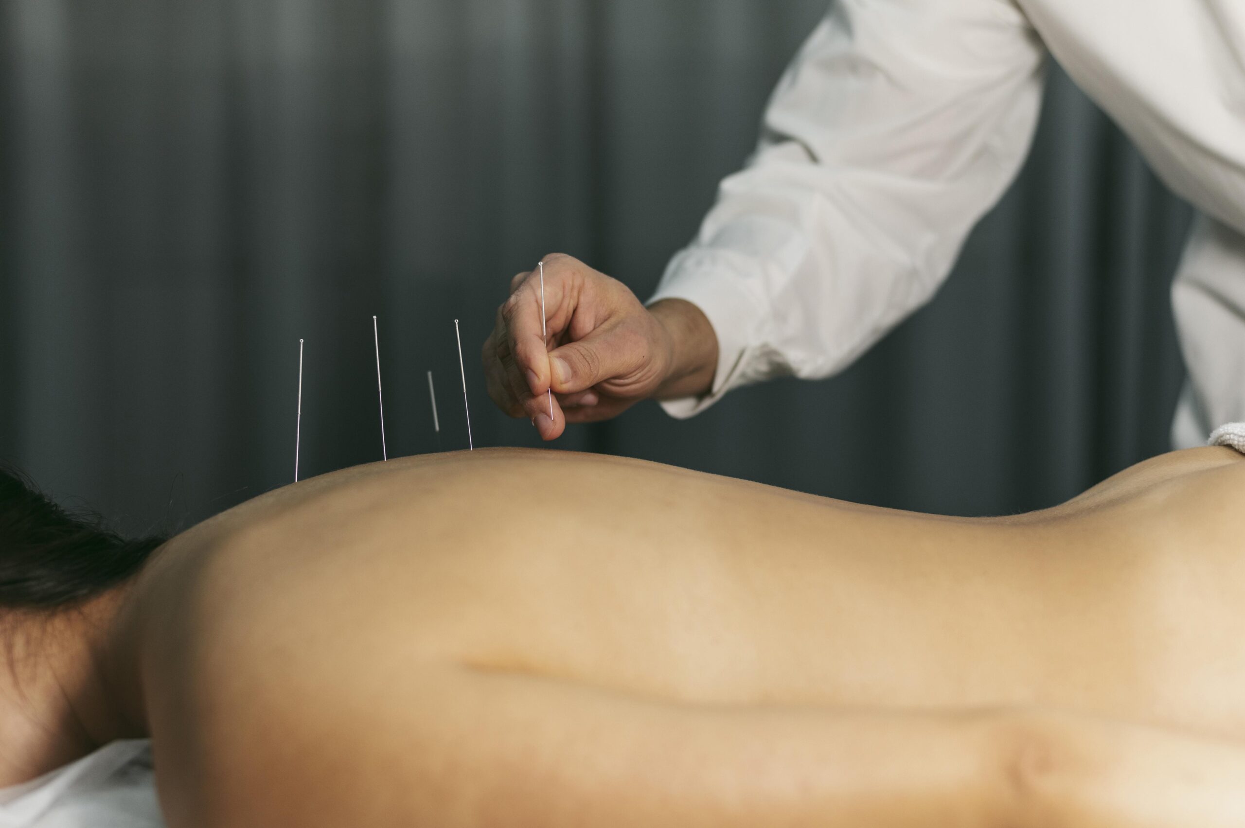 acupuncture-process